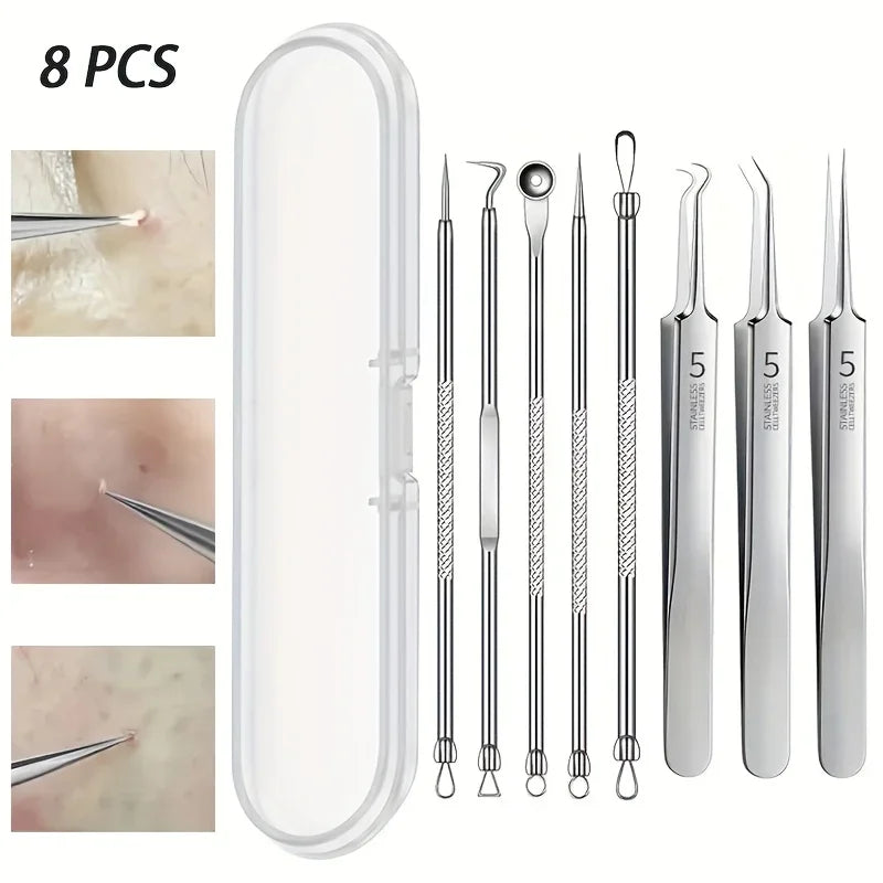 7/8 Piece Blackhead Remover Kit – Stainless Steel Blemish & Acne Extraction Tools – Professional Pimple Popper Set for All Skin